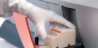 Diagnóstico directo de Candida con RM miniaturizada