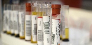 CDC braces for wave of Zika cases