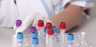 Endogenous oxidants: New methods for monitoring processes in the organism