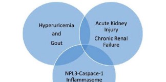 Uric acid, gout and kidney disease: The chicken or the egg?