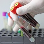 necrosismiocardioNL