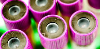 Blood test supports use of potential new treatment for patients with stomach cancer