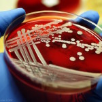 staphylococcusNL