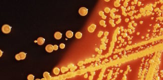 Se detecta la primera infección de Escherichia coli con genes móviles preocupantes en Estados Unidos
