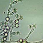 candida_albicans