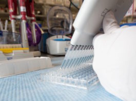 Eliminating creatine kinase–myocardial band testing in suspected acute coronary syndrome