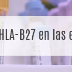 HLA-B27