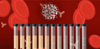 Paso a paso: cómo la sangre de sobrevivientes del COVID-19 podría salvar a las personas contagiadas