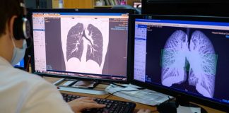 How does COVID-19 kill? Uncertainty is hampering doctors’ ability to choose treatments