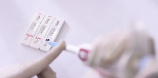 Los análisis en el labortorio clínico, pieza clave para luchar contra la pandemia de la COVID-19